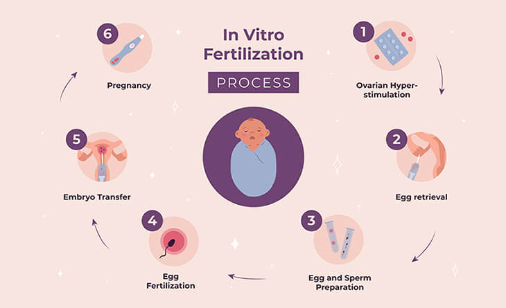 best ivf centre in Delhi