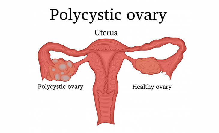 infertility specialist