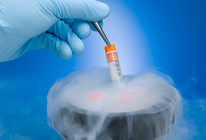 Best IVF & Infertility specialist in Delhi
