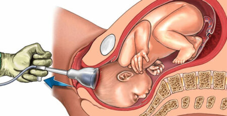 Best gynaecologist in Delhi
