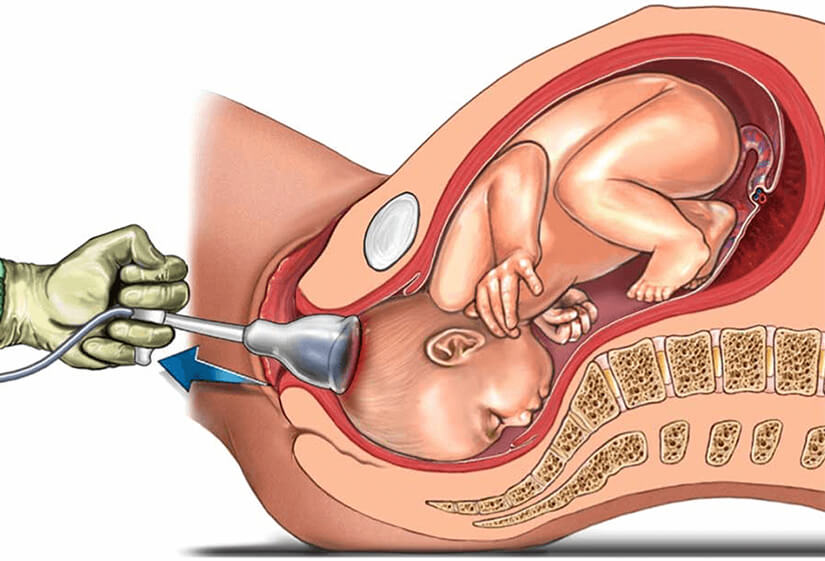 Best gynaecologist in Delhi