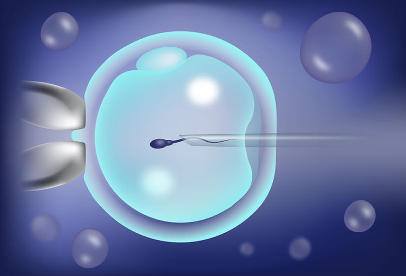 Best IVF Doctors in Delhi