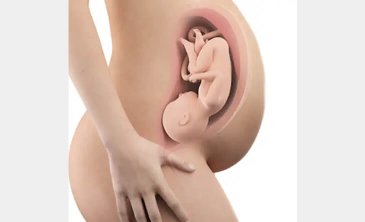 Best gynaecologist in Delhi