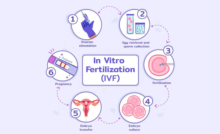 IVF Treatment