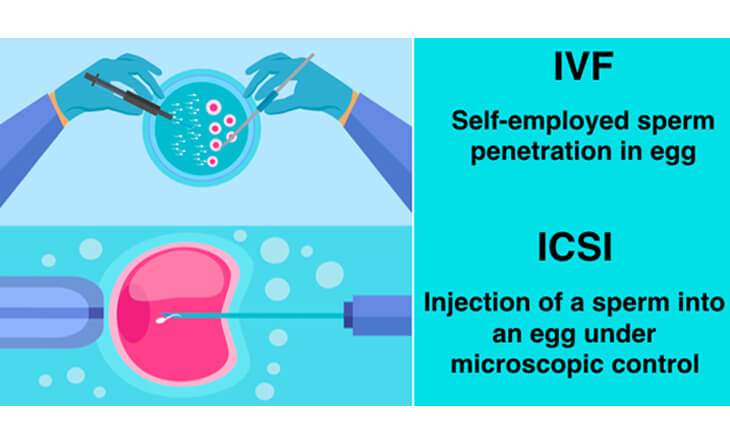 IVF Treatment