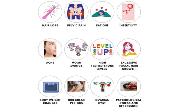 PCOS treatment