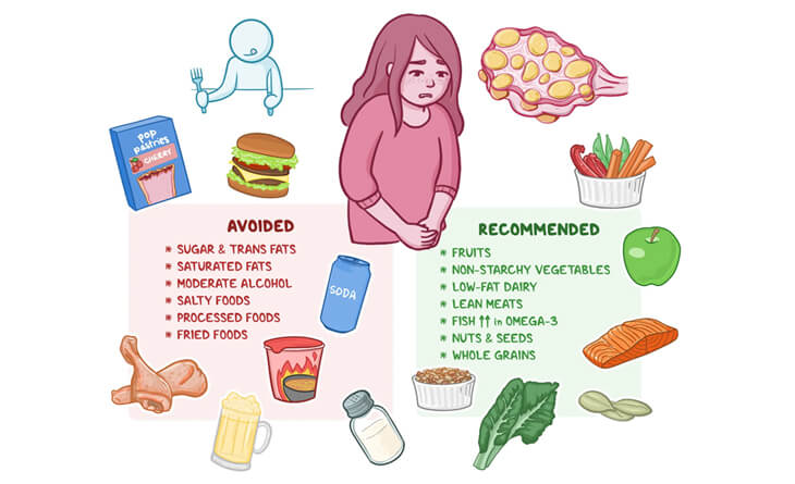 PCOS Treatment in Delhi