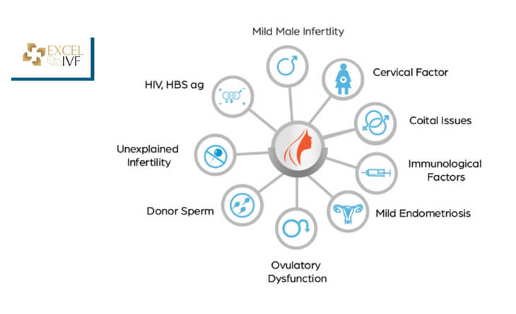 IUI Treatment