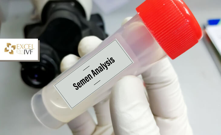 Azoospermia treatment