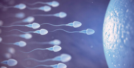 Azoospermia treatment
