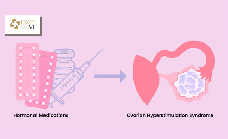 IVF treatment