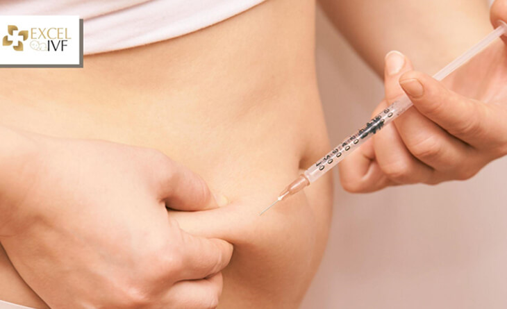 IVF treatment