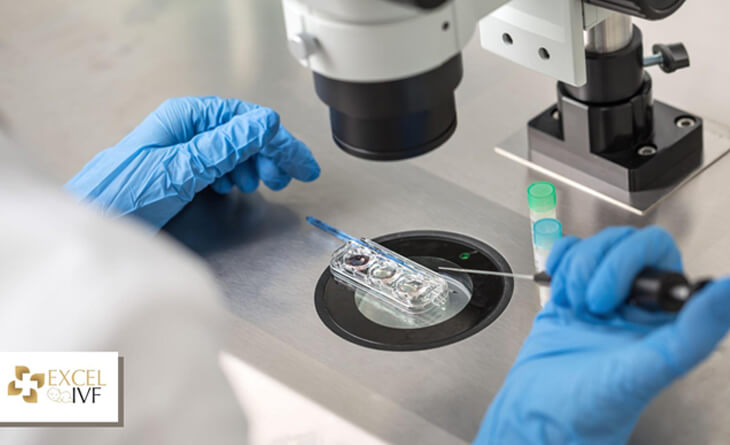 IVF Treatment