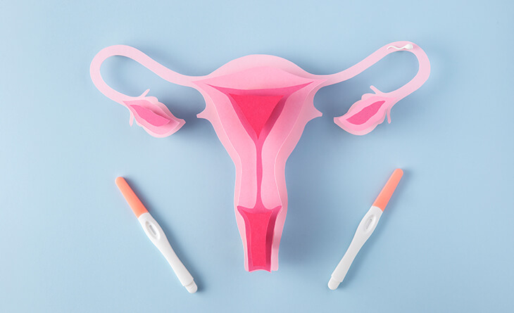 Secondary infertility