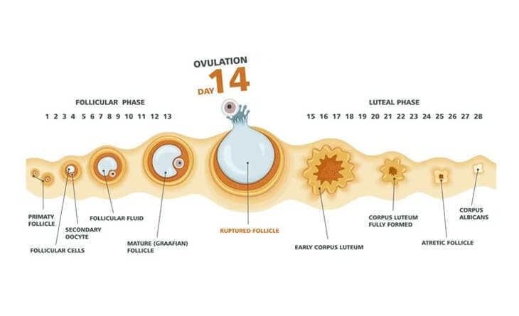 Causes of Infertility in Women