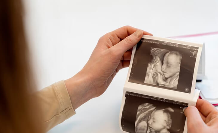 IVF Treatment