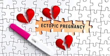 IVF Treatment
