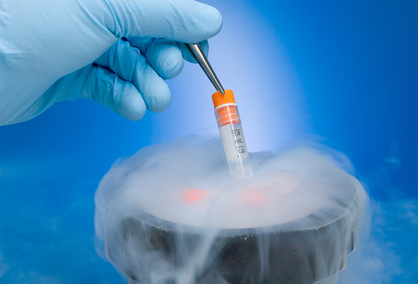 egg freezing