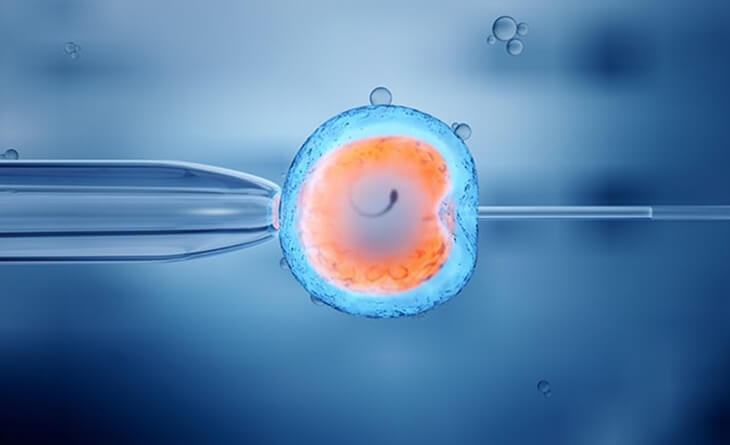 IVF Treatment