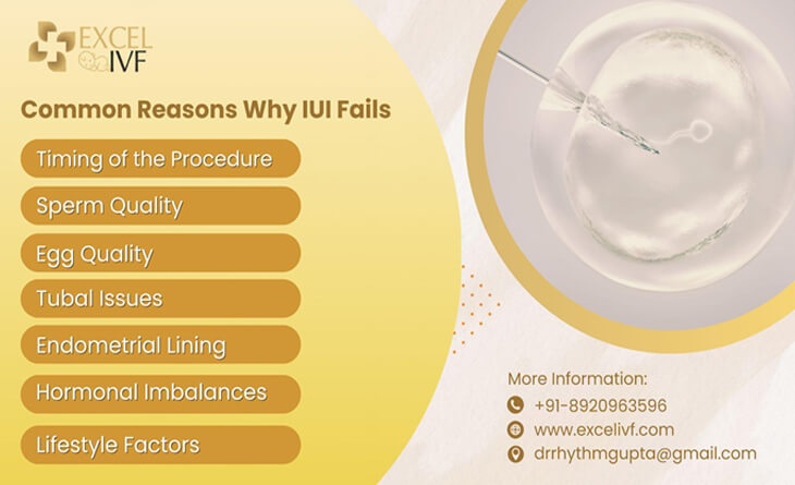IUI Treatment