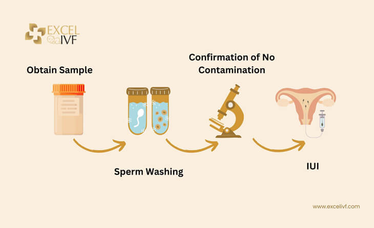 IUI Treatment