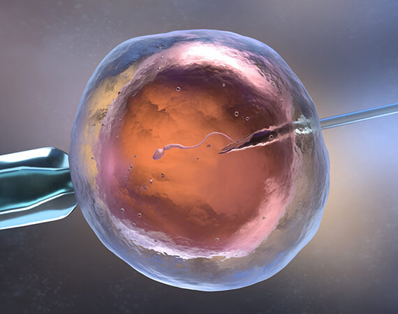 AI in Embryo Selection - Advanced IVF Technology at Excel IVF Delhi -01