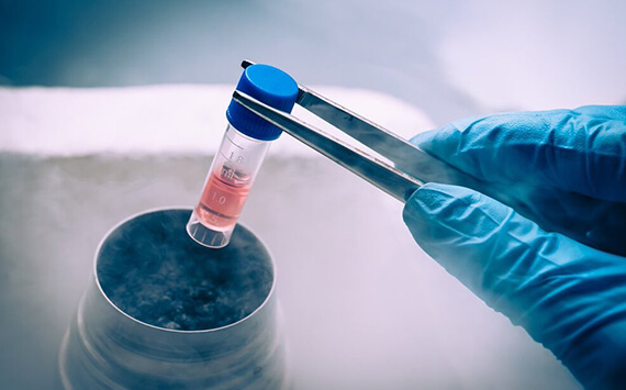 Fertility Preservation in Delhi - Dr Rhythm Gupta - Excel IVF -01