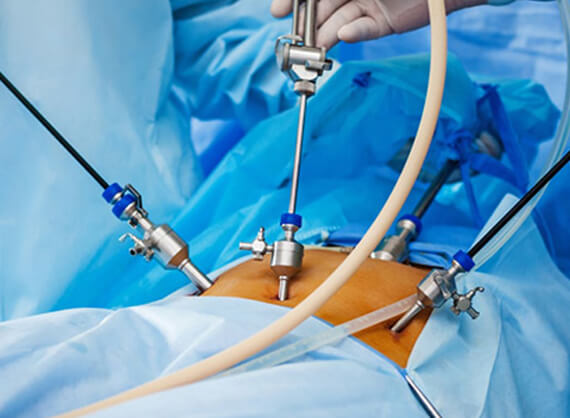 laparoscopy for infertility - Dr Rhythm Gupta